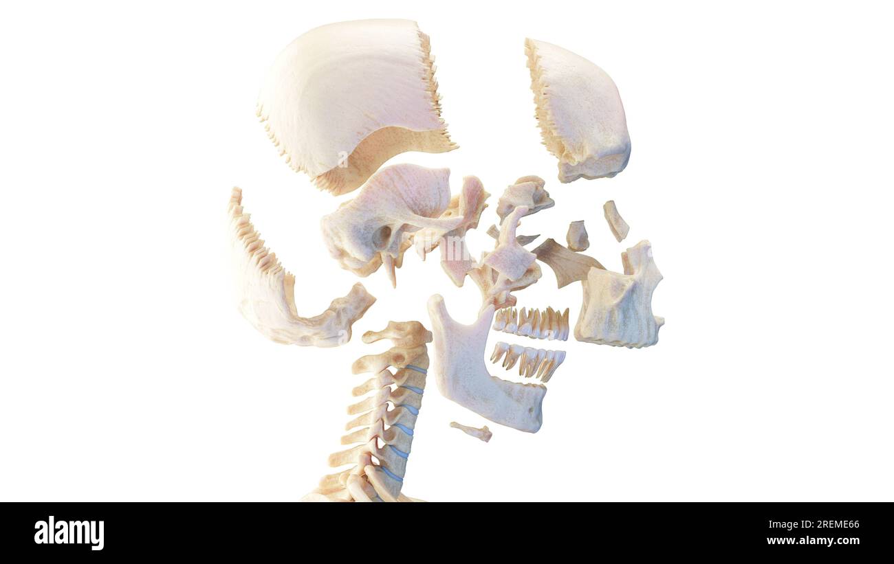 Ein zerteilter menschlicher Schädel, Illustration. Stockfoto