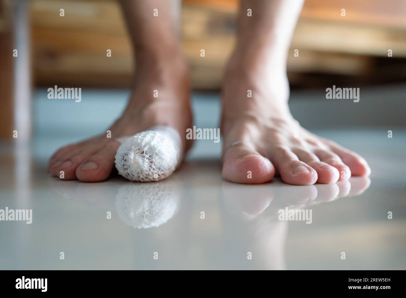 Ein verletzter Zeh mit Netzverband Stockfoto