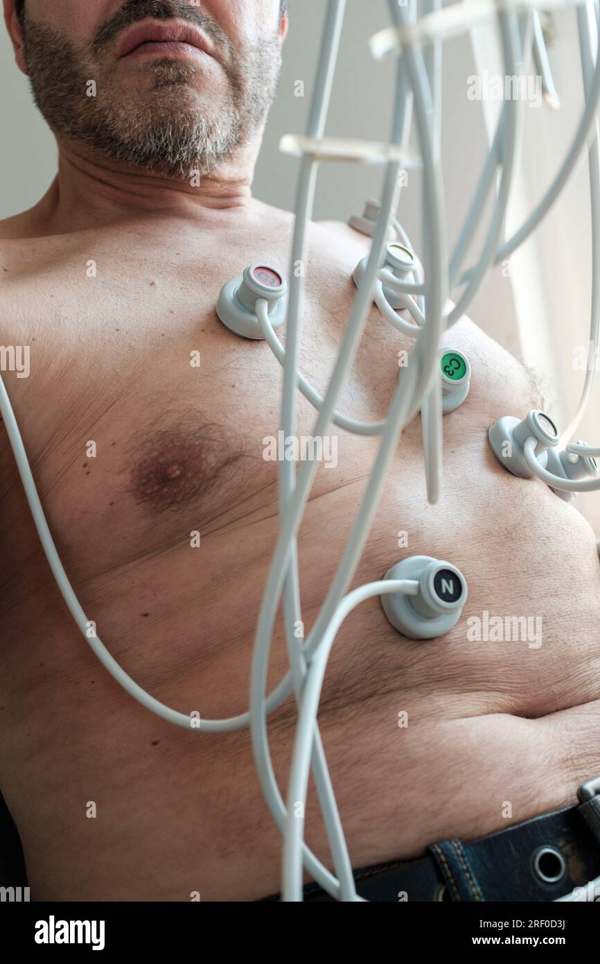 Übergewichtiger Mittelalter mit EKG, Elektrokardiogramm in der kardiologischen Praxis Stockfoto