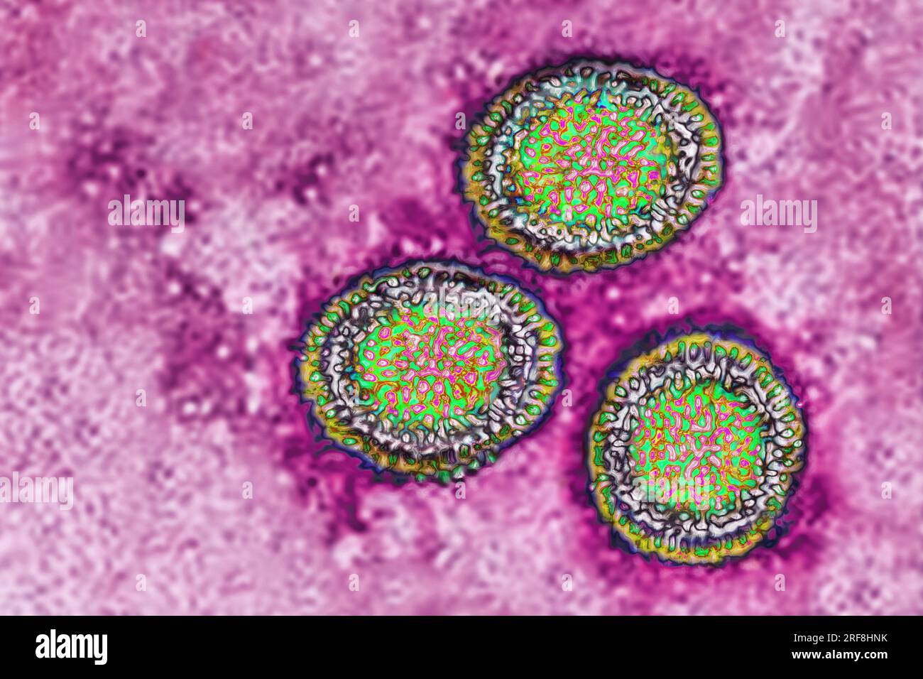 Influenzavirus der Familie der Orthomyxoviridae (respiratorische Virusinfektion). Transmissionselektronenmikroskopie, Virusdurchmesser 80 bis 120 Nanometer. Stockfoto