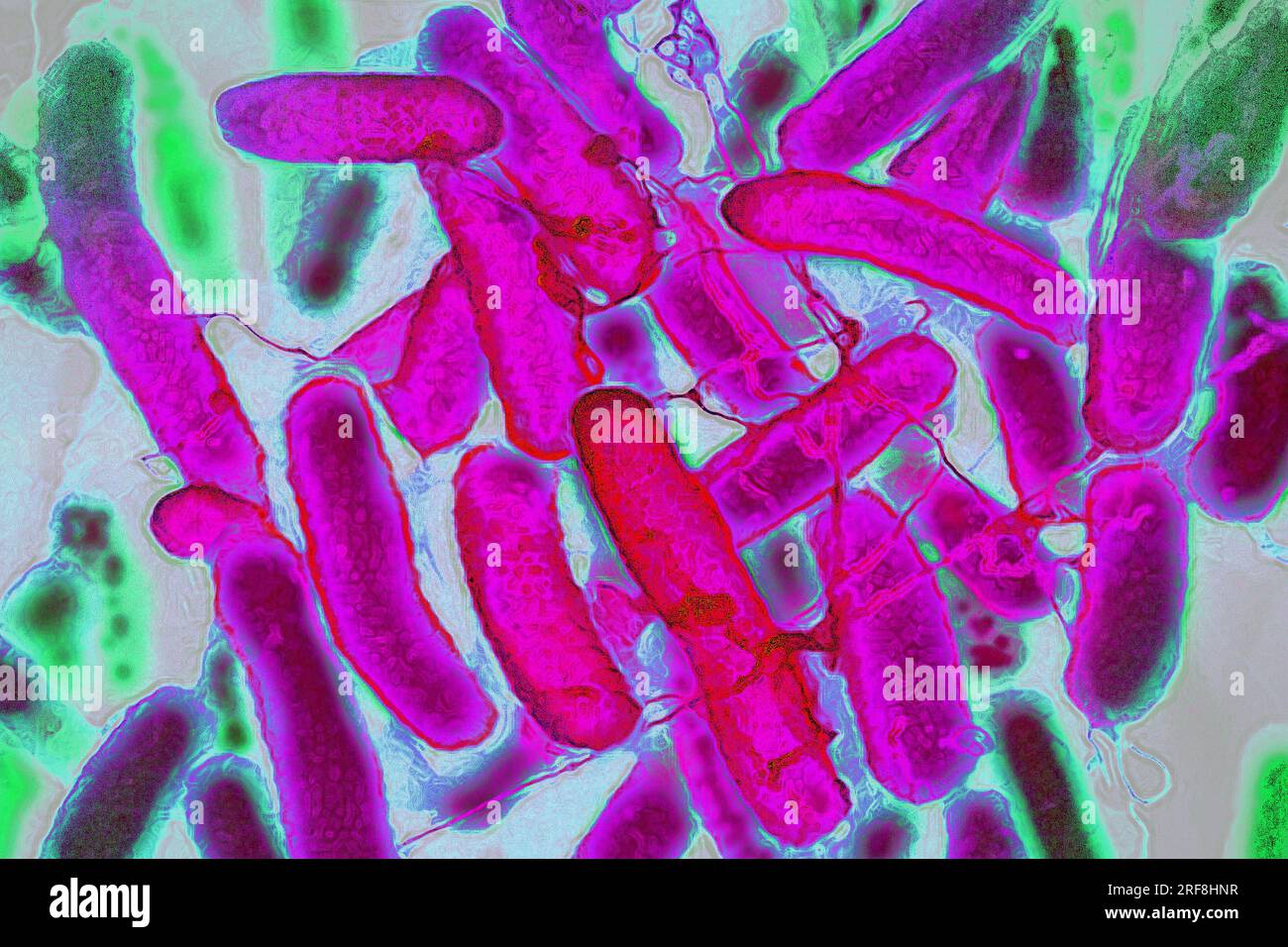 Escherichia coli (Darmbakterien, die sich im Verdauungstrakt von Menschen und Warmblütern befinden, sind die Ursache für Lebensmittelvergiftungen. Stockfoto