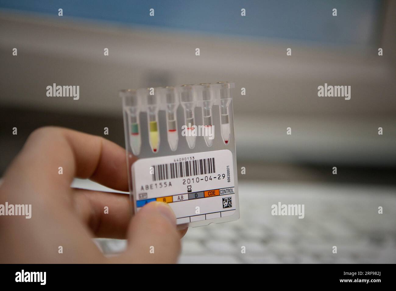 Geräte zur Bestimmung von Blutgruppen in einem Krankenhausanalyselabor, Ergebnis. Stockfoto