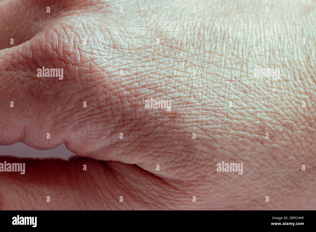 Nahaufnahme der zerknitterten Haut an der Hand eines älteren Mannes mit einigen Läsionen aktinischer Keratose oder Sonnenflecken. Die Konsistenz der menschlichen Haut. Stockfoto