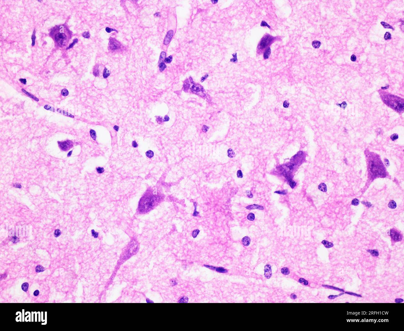 Histologie des menschlichen Gehirngewebes bei 400x-Vergrößerung mit Hämatoxylin- und Eosin-Färbung. Stockfoto