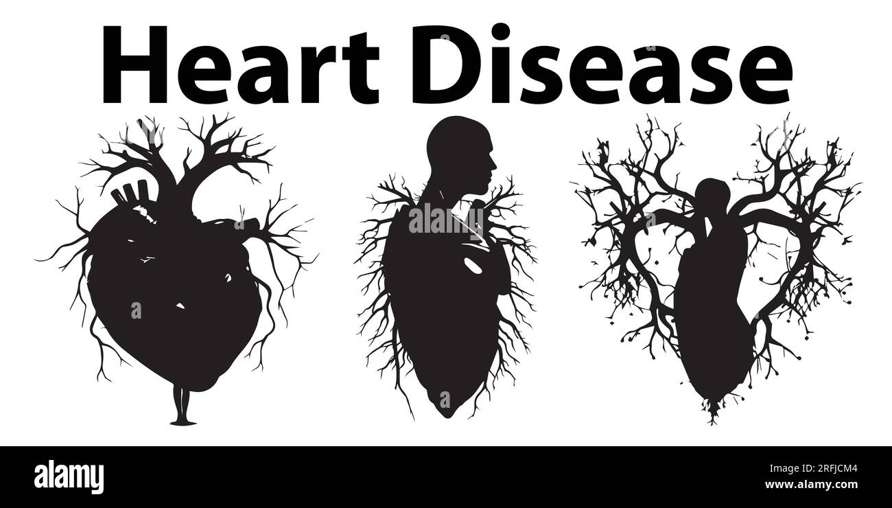 Silhouette Herzkrankheit Vektor-Illustration Stock Vektor