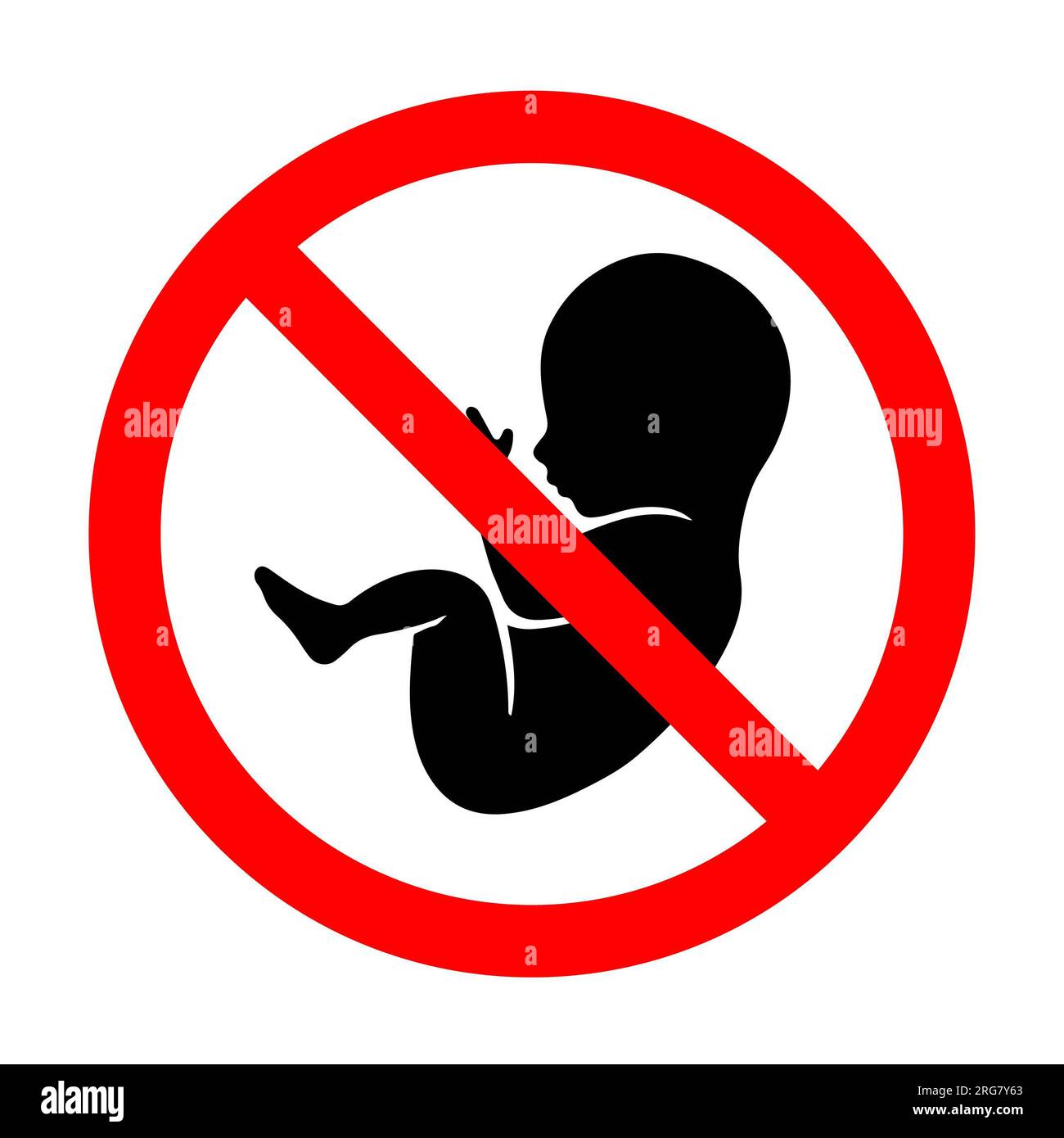 Verbotsschild mit Baby, Abtreibung auf weißem Hintergrund. Isolierte Darstellung. Stockfoto