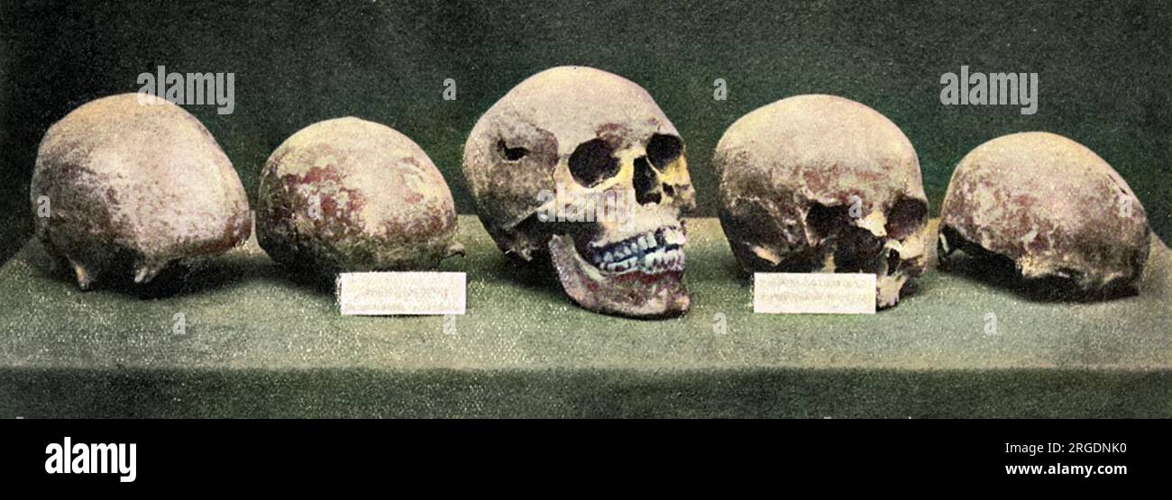 Fünf Schädel, gefunden in Winchester. Als dieses Bild 1901 im Tatler veröffentlicht wurde, glaubte man, dass der zentrale Schädel der von Alfred dem Großen war, und die anderen die seiner Familie. Stockfoto