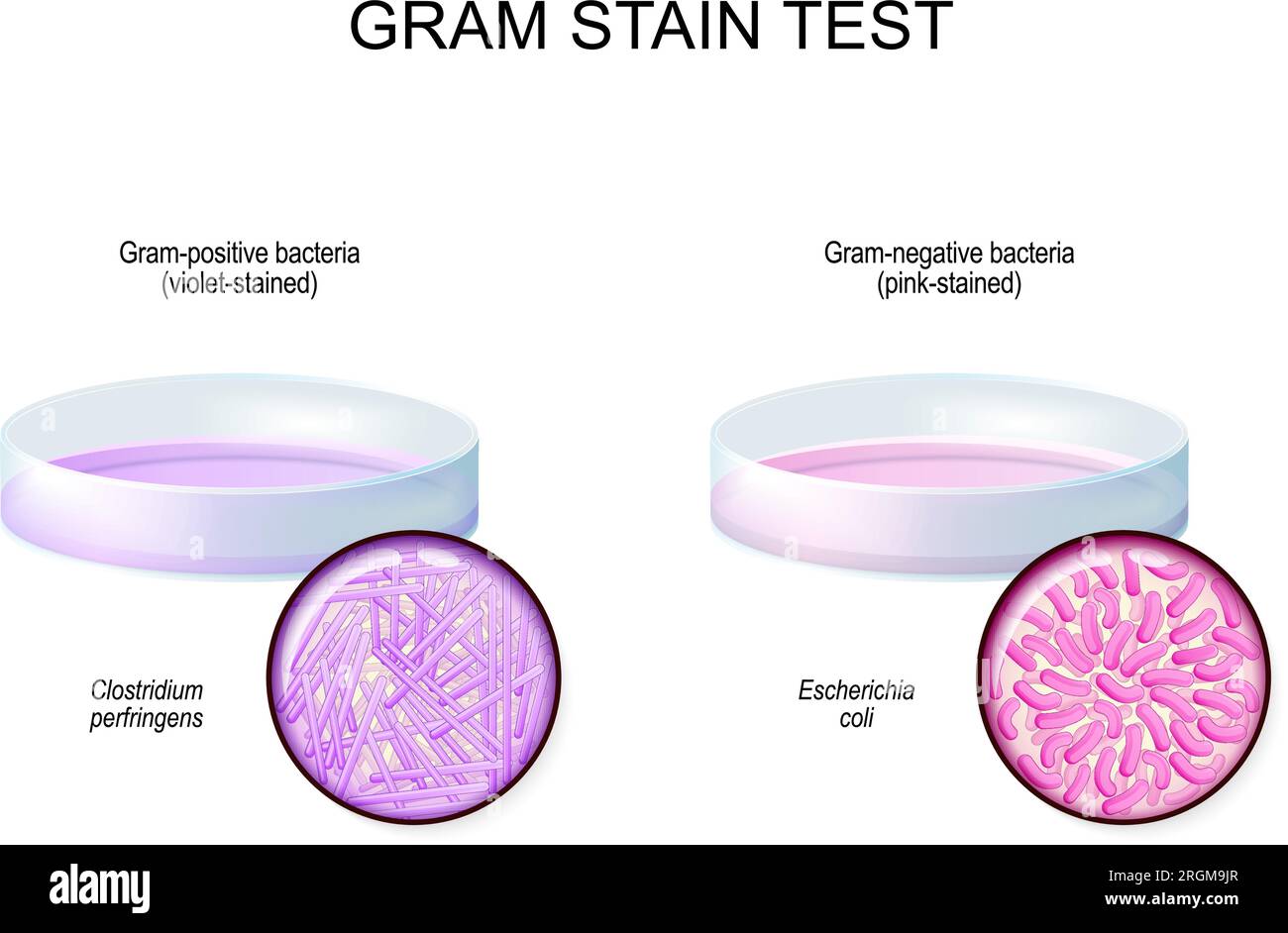 Gram-Färbetest. Glas-Petrischale mit Gram-negativen Bakterien Escherichia coli nach Verwendung von Kristallviolettfärbung. Nahaufnahme von Gram-positiv Stock Vektor