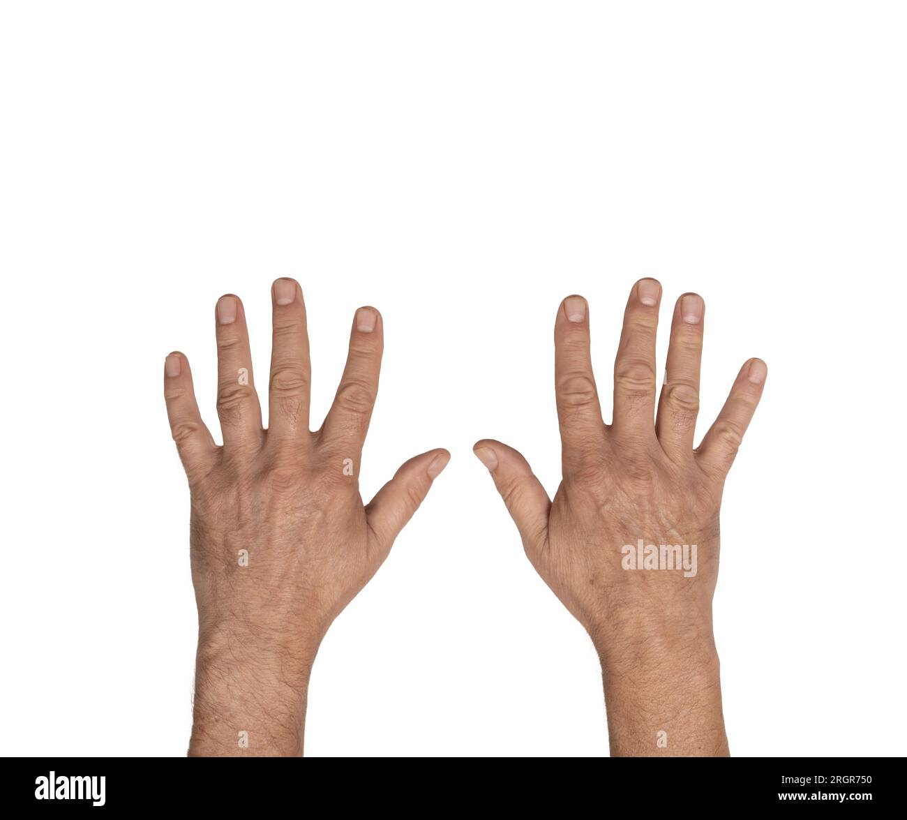 Der Rücken der Hände eines Mannes auf einem transparenten Hintergrund Stockfoto