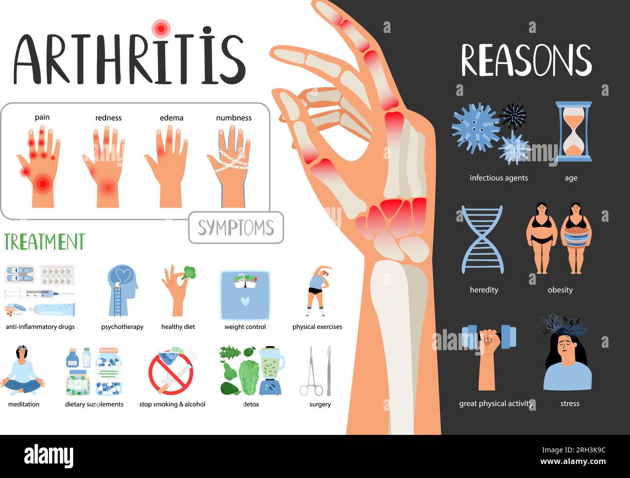 Medizinisches Vektorposter zur rheumatoiden Arthritis. Symptome
