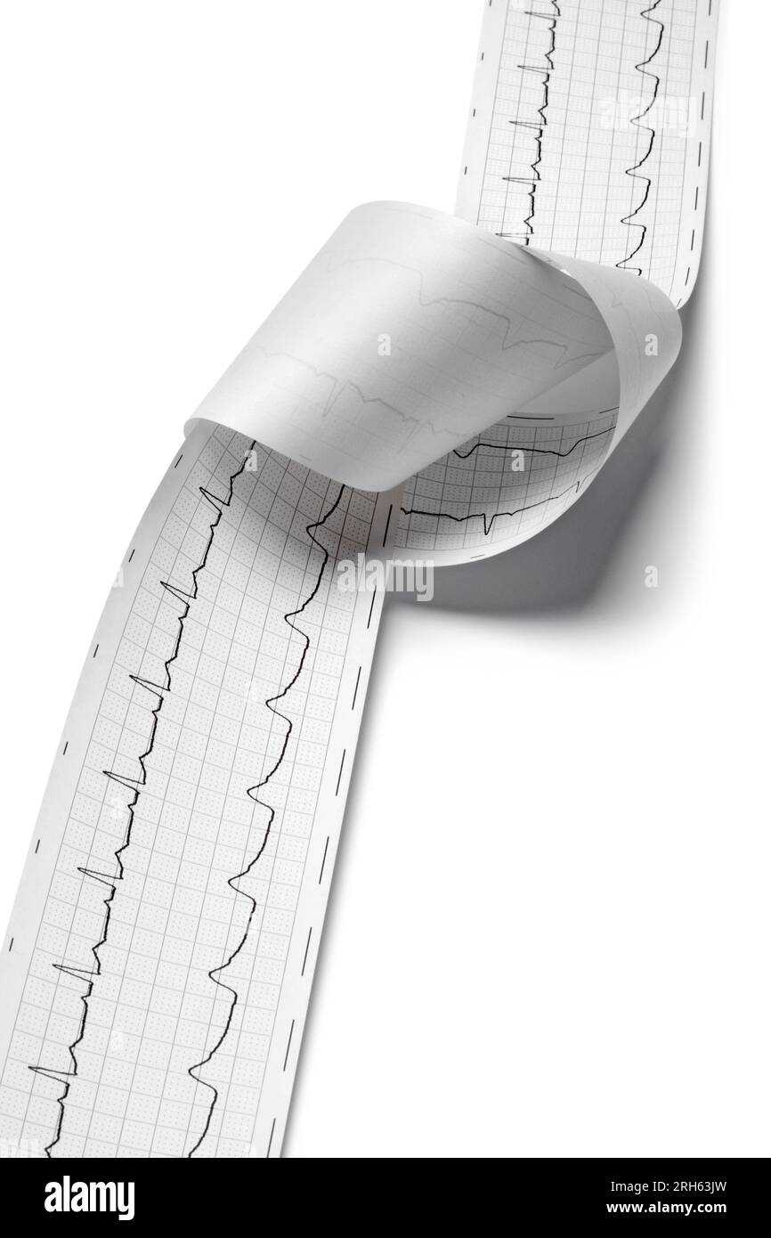 Regelmäßiger Ausdruck von Elektrokardiogramm, ekg und Nahaufnahme auf weißem Hintergrund Stockfoto