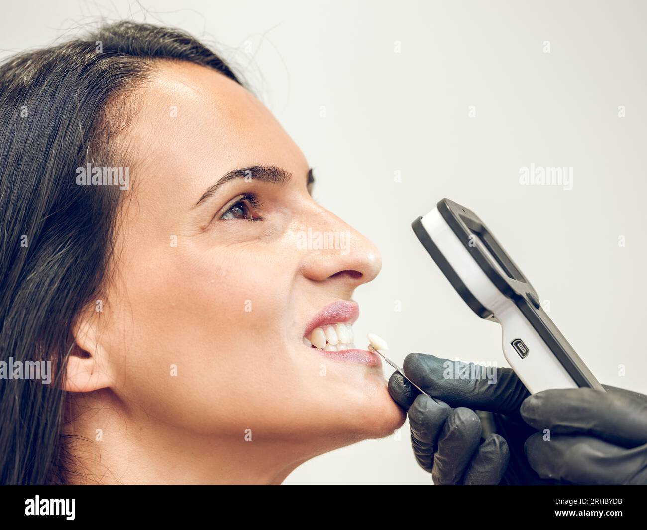 Seitenansicht eines gesichtslosen Stomatologen mit Schattenskala auf den Zähnen der Mandantin bei der Bestimmung des Zahnschattens Stockfoto