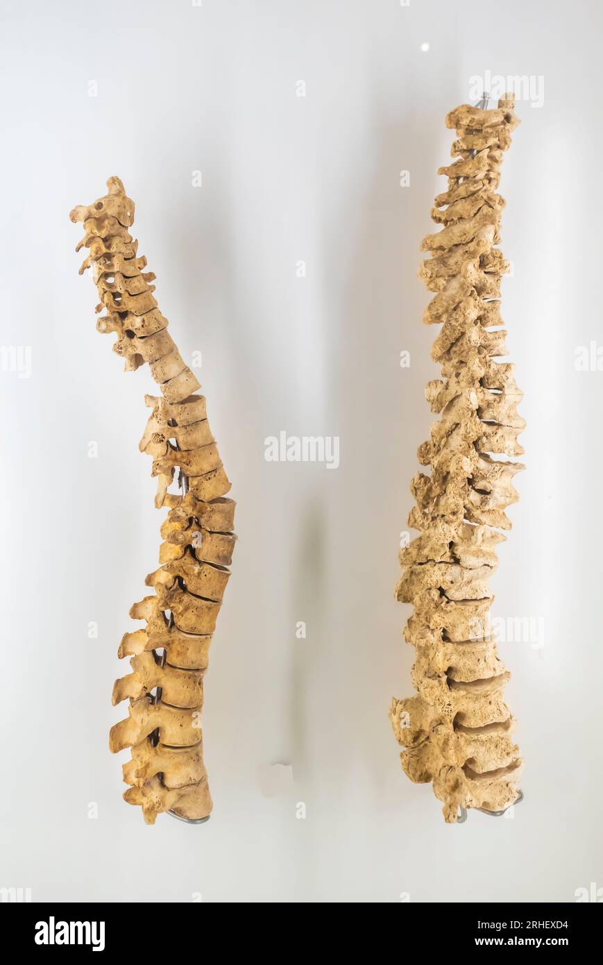 Wirbelsäulen- Friedhof Madinat Hamad - Anfang Dilmun 2000 - 1800 v. Chr. Stockfoto