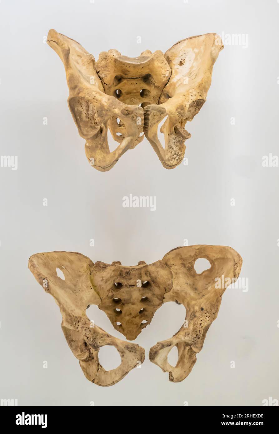 Männlicher Hüftknochen, weiblicher Hüftknochen - Madinat Hamad Friedhof - Anfang Dilmun 2000 - 1800 v. Chr. Stockfoto