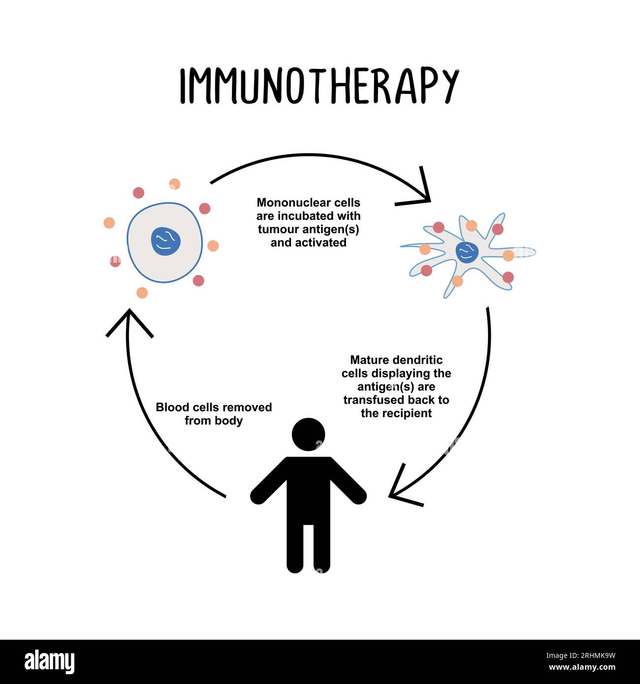 Immuntherapie: Die Verwendung von Medikamenten oder anderen Substanzen, um das Immunsystem des Körpers zu stimulieren, Krebszellen zu erkennen und anzugreifen. Stock Vektor