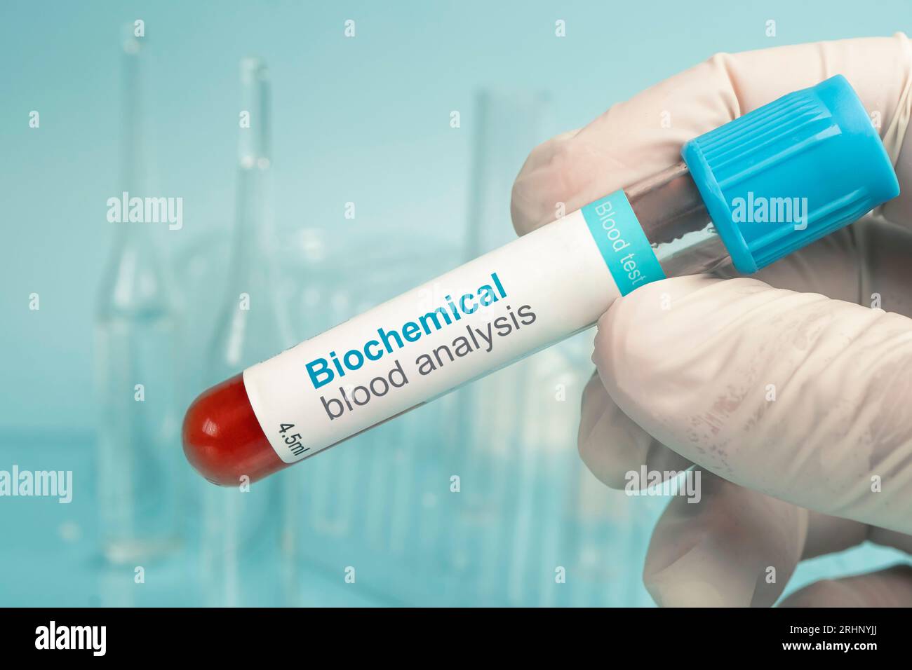 Blutproben und Arztpraxis in ärztlicher Hand. Biochemische Blutanalyse. Biochemische Zusammensetzung des Blutes des Patienten. Stockfoto
