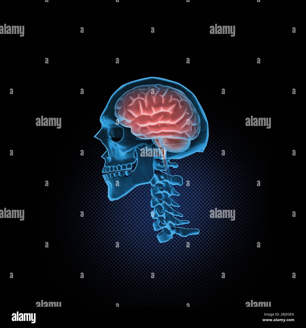 Medizinische Illustration des menschlichen Gehirns im Inneren des Schädels Stockfoto