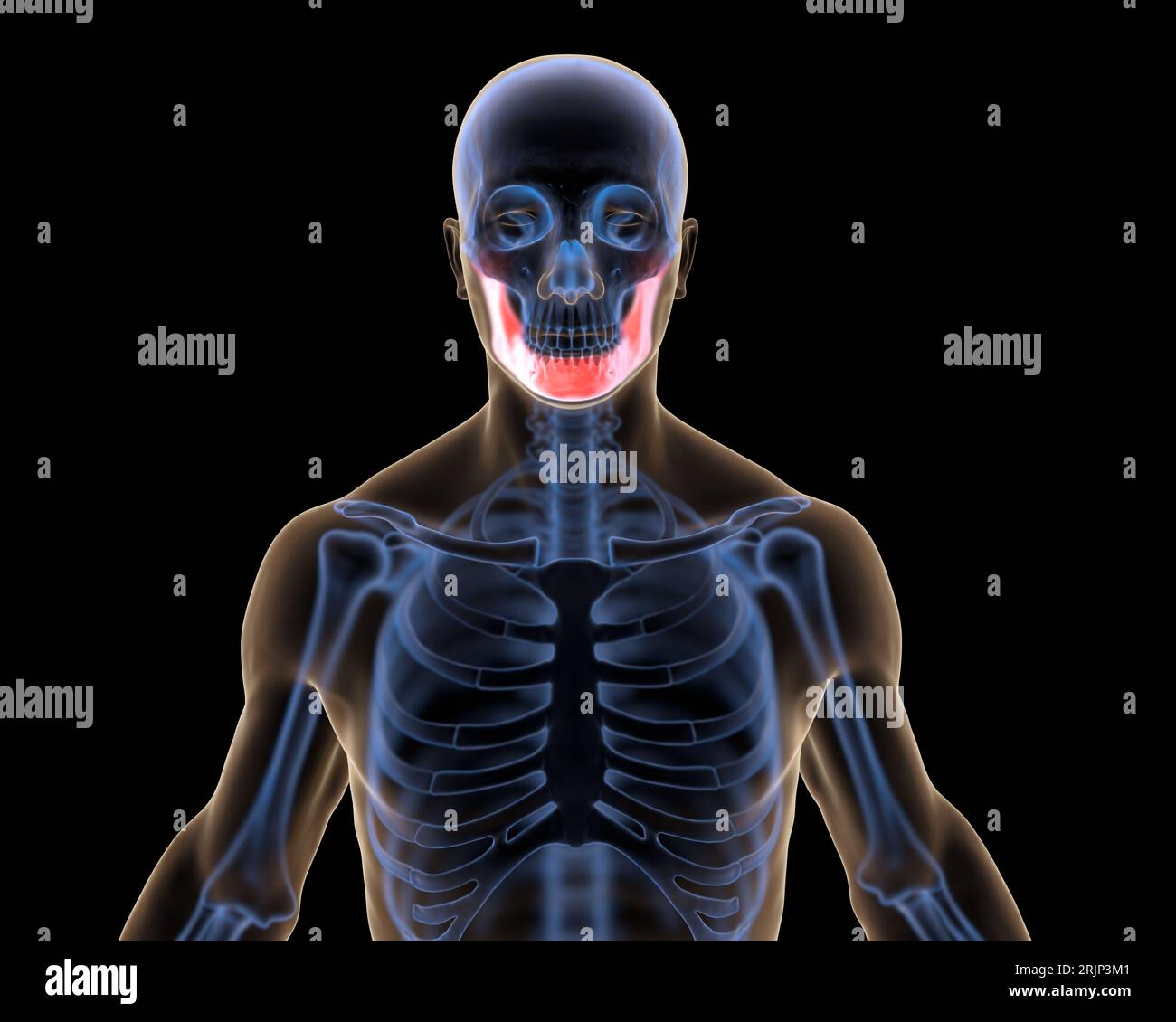 Röntgenunterkiefer in Red Highlights Stockfoto