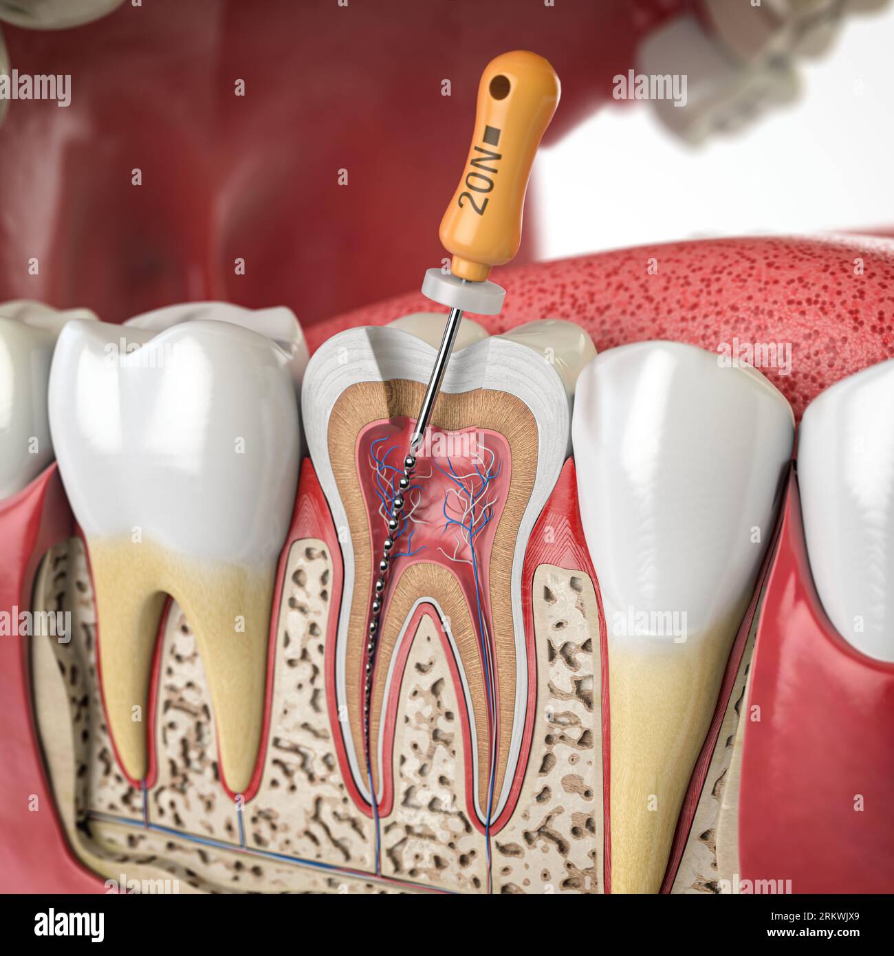 Querschnitt des menschlichen Zahnes mit endodontischer Drehfeile. 3D-Abbildung Stockfoto