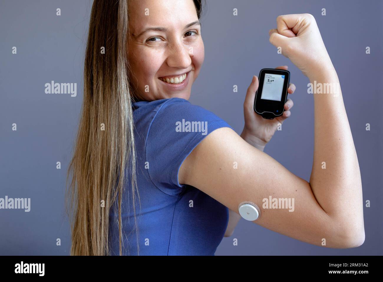 Das Mädchen zeigt ihren Glukosemonitor mit normalem Blutzuckerspiegel, ein Pflaster auf der Hand Stockfoto