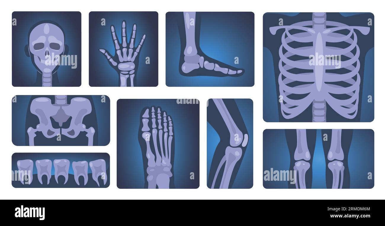 Röntgenaufnahmen. Menschliches Skelett und Körperteile, medizinische Diagnose und Gesundheitskonzept, Anatomie und Wissenschaftsvektorset Stock Vektor
