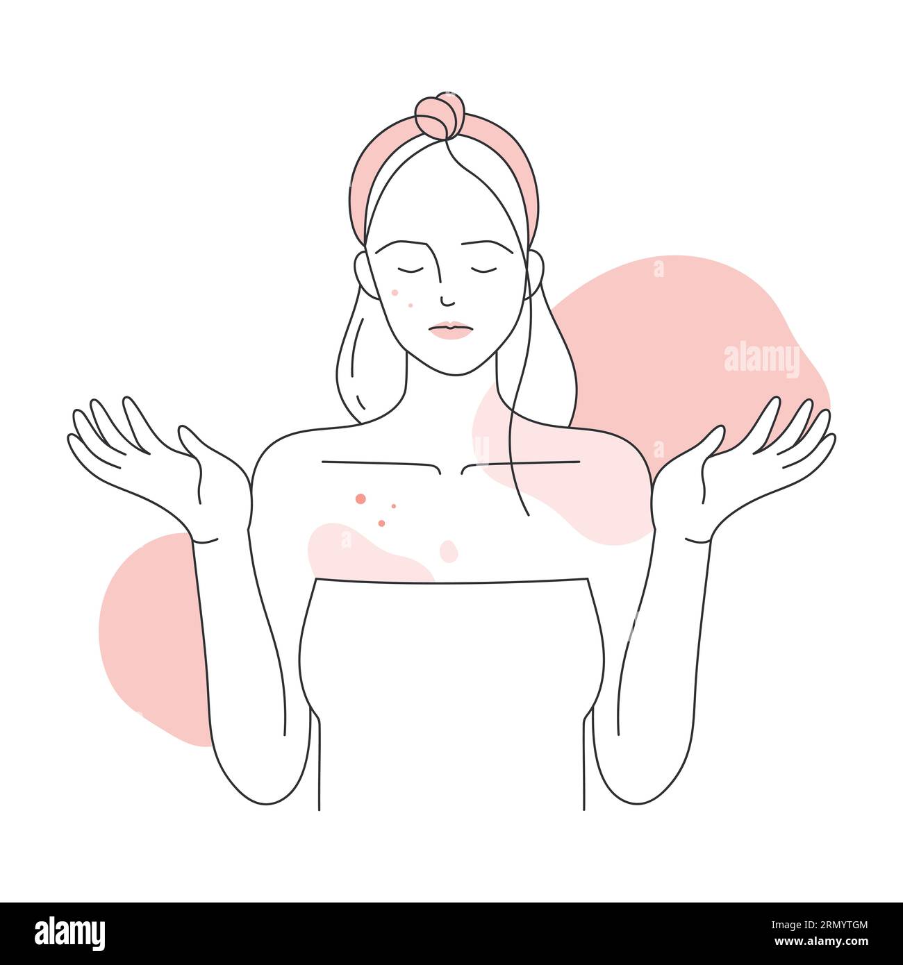 Mädchen mit Hautallergien. Juckende Körperhaut, bedeckt mit roter Hautausschlag-Vektor-Illustration Stock Vektor