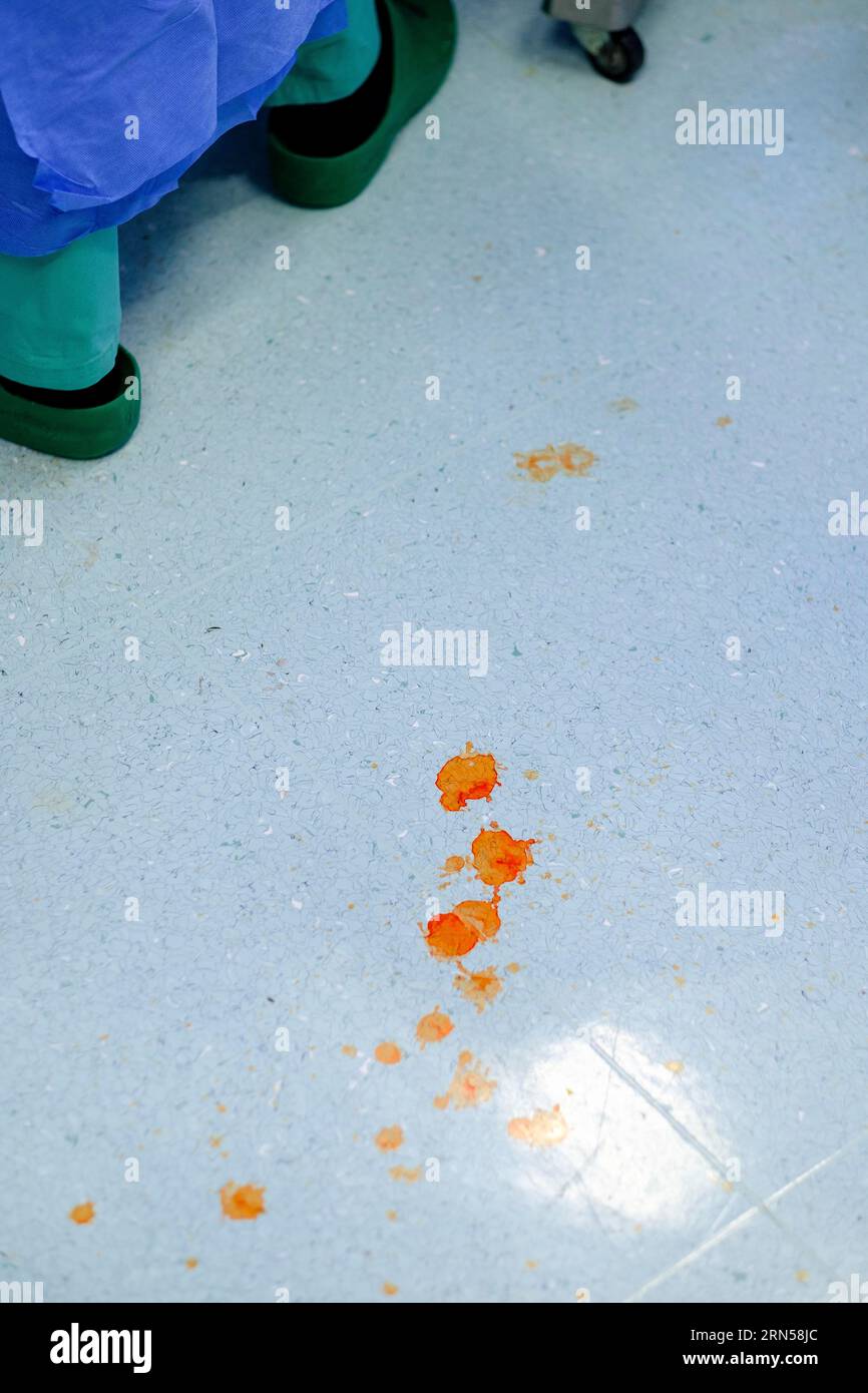Blutspritzer auf dem Boden eines Operationssaals im Krankenhaus Stockfoto