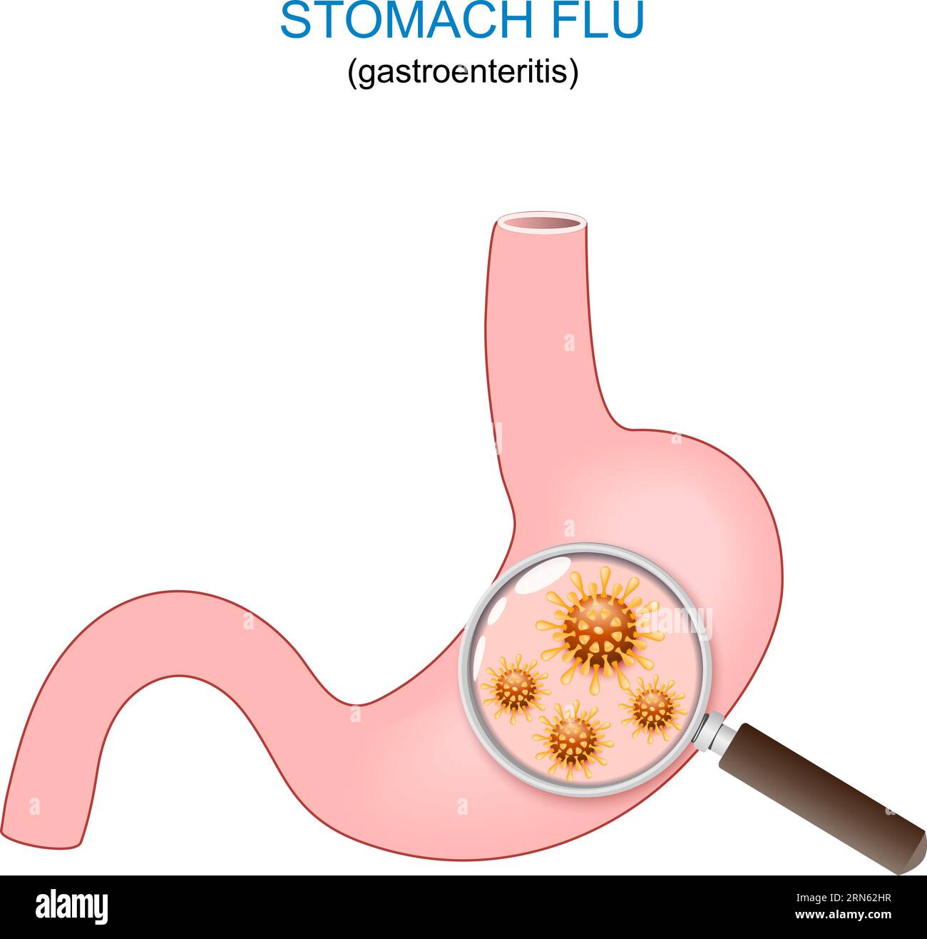Magengrippe. Menschlicher Magen isoliert auf weißem Hintergrund. Close-up von Gastroenteritis-verursachenden Viren. Vektorillustration Stock Vektor