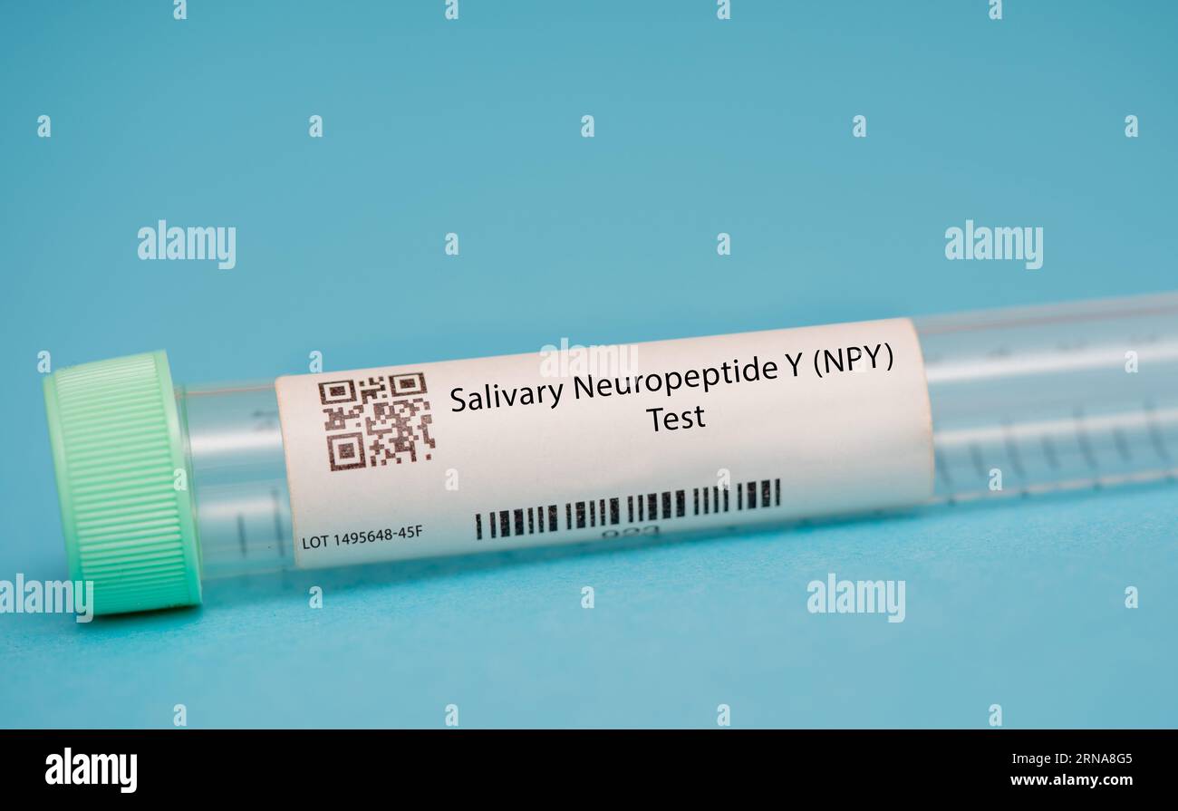 Speichelneuropeptid Y (NPY) Test dieser Test misst die Niveaus von NPY, einem Neurotransmitter, der an der Stressreaktion des Körpers und dem Immunsystem beteiligt ist Stockfoto