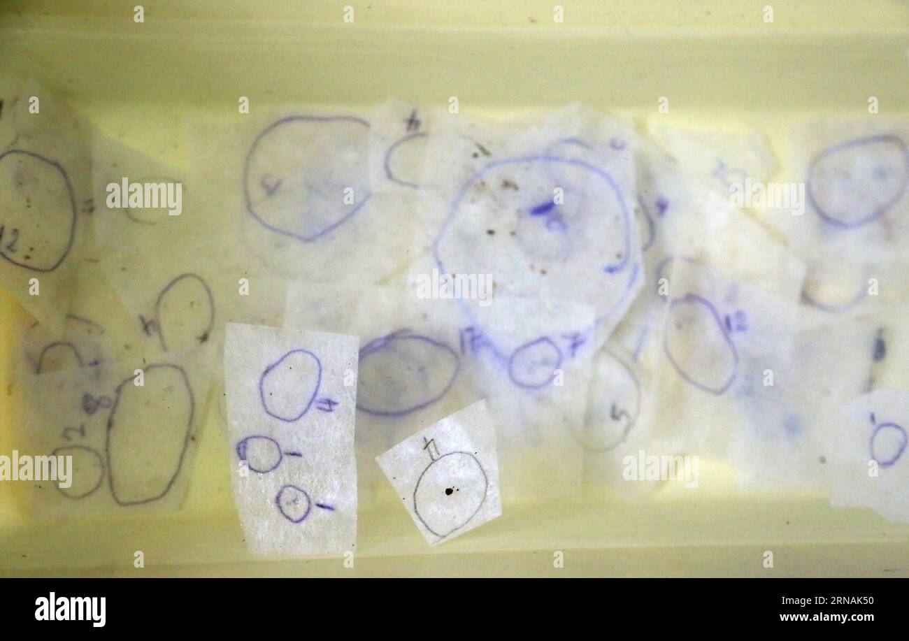 (160130) -- SAN JOSE, 30. Januar 2016 -- Eier und Larven der Aedes aegypti-Mücke, dem Träger des Zika-Virus, werden am 29. Januar 2016 in einem Labor des Gesundheitsministeriums in San Jose, Costa Rica, ausgestellt. Die Weltgesundheitsorganisation (WHO) sagte am Donnerstag, sie werde einen Notfallausschuss der Internationalen Gesundheitsvorschriften zum Zika-Virus einberufen, um festzustellen, ob der Ausbruch eine gesundheitliche Notlage von internationaler Bedeutung darstellt. Kent Gilbert) (jp) (sp) COSTA RICA-SAN JOSE-HEALTH-ZIKA e KENTxGILBERT PUBLICATIONxNOTxINxCHN San Jose Jan 30 2016 Eier und Larven der Aedes Stockfoto