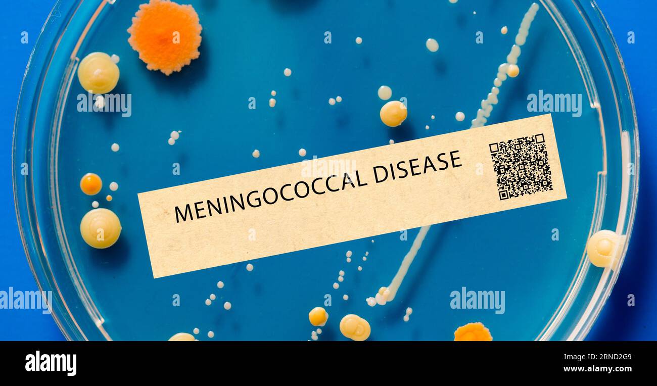 Meningokokken-Krankheit - bakterielle Infektion, die Meningitis und Sepsis verursachen kann. Stockfoto