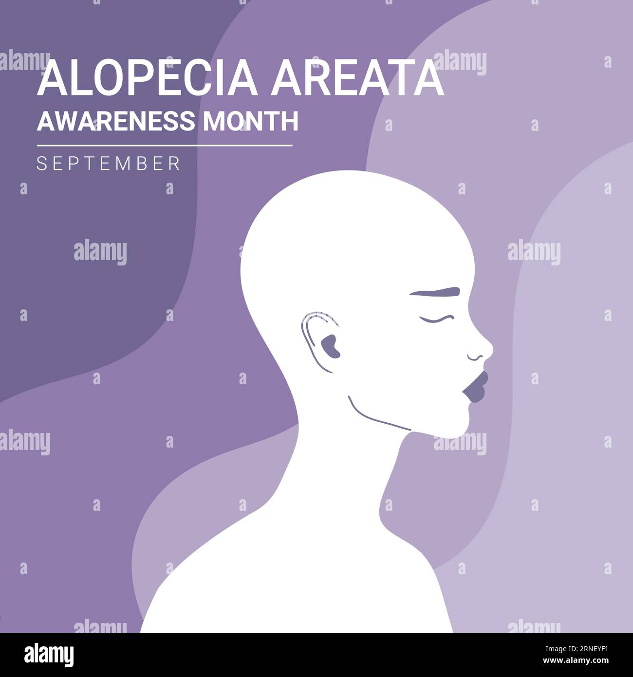 Poster zum Thema Alopezie-Sensibilisierung. Frau mit Glatzkopf-Silhouette. Vektorillustration Stock Vektor