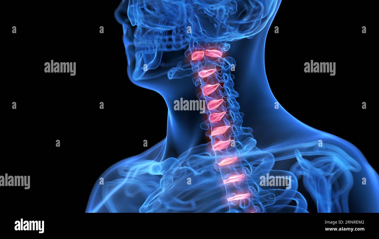 Bandscheiben der Halswirbelsäule, Illustration Stockfoto