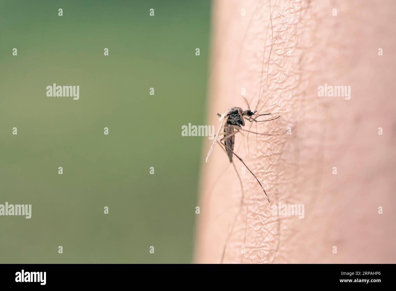 Mücke voller Blut. Eine Mücke saugt Blut aus einem menschlichen Körper. Makrofoto einer Mücke am Arm Stockfoto