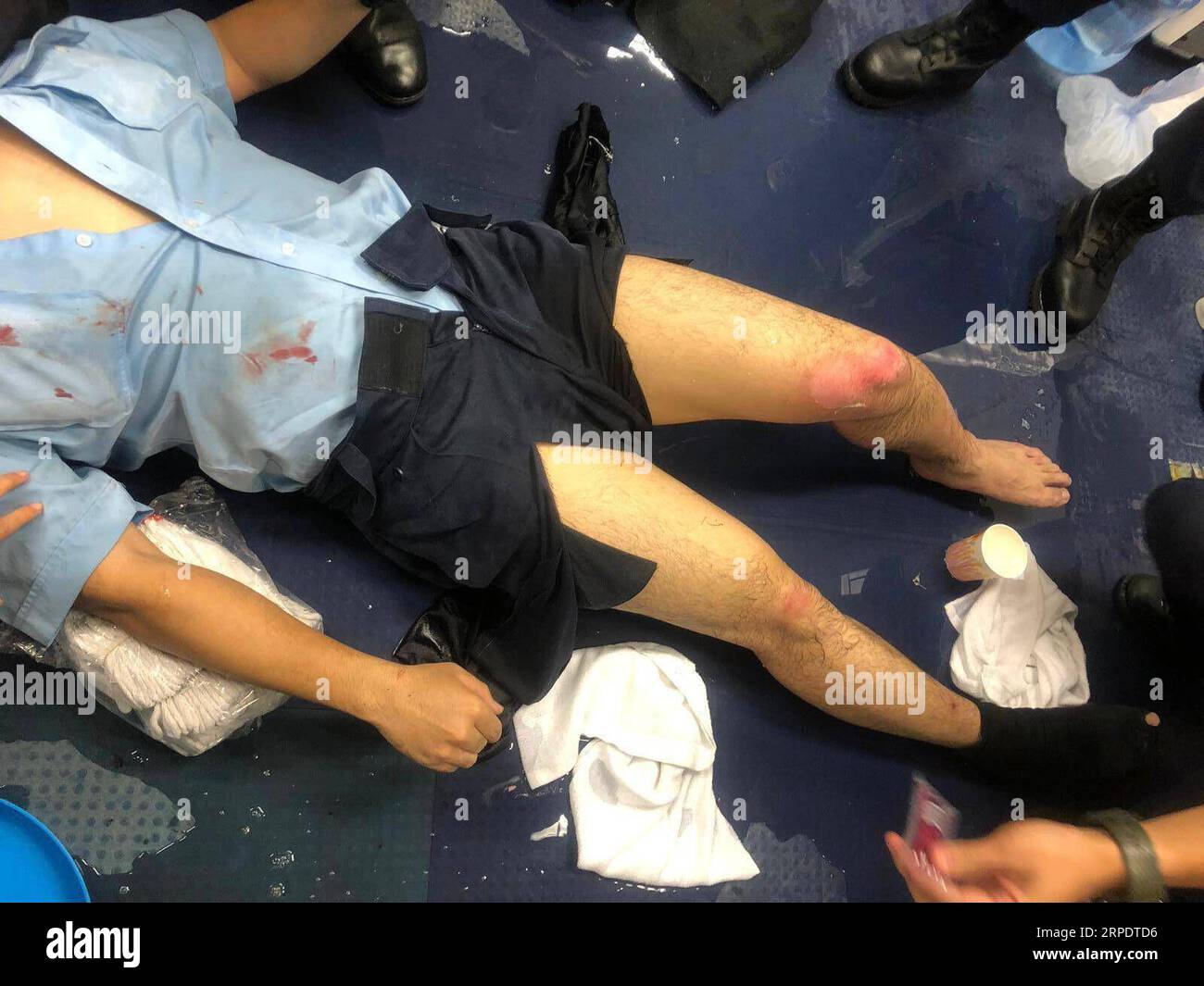 News Bilder des Tages (190812) -- HONGKONG, 12. August 2019 -- Foto vom 11. August 2019 zeigt einen verletzten Polizeibeamten in Hongkong. Ein Polizist wurde schwer verletzt, als am Sonntagabend an mehreren Orten in Hongkong Benzinbomben auf Polizeibeamte geworfen wurden. CHINA-HONG KONG-POLIZIST-VERLETZT WUXXIAOCHU PUBLICATIONXNOTXINXCHN Stockfoto