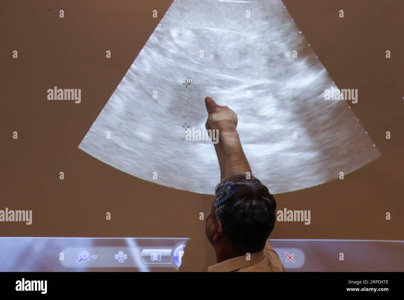 (190815) -- BERLIN, 15. August 2019 -- Thomas Hildebrandt, Leiter der Abteilung Reproduktionsmanagement am Leibniz-Institut für Zoo- und Wildtierforschung, weist auf die Position des Embryos bei einer Pressekonferenz am 14. August 2019 im Zoo Berlin in der Hauptstadt Deutschlands hin. Der Zoo Berlin bereitet sich darauf vor, ein oder zwei neugeborene Panda-Jungen willkommen zu heißen, da Experten sagen, dass es sehr wahrscheinlich ist, dass der 6-jährige Panda Meng Meng schwanger ist. ) DEUTSCHLAND-BERLIN-ZOO-PANDA-SCHWANGERSCHAFT ShanxYuqi PUBLICATIONxNOTxINxCHN Stockfoto