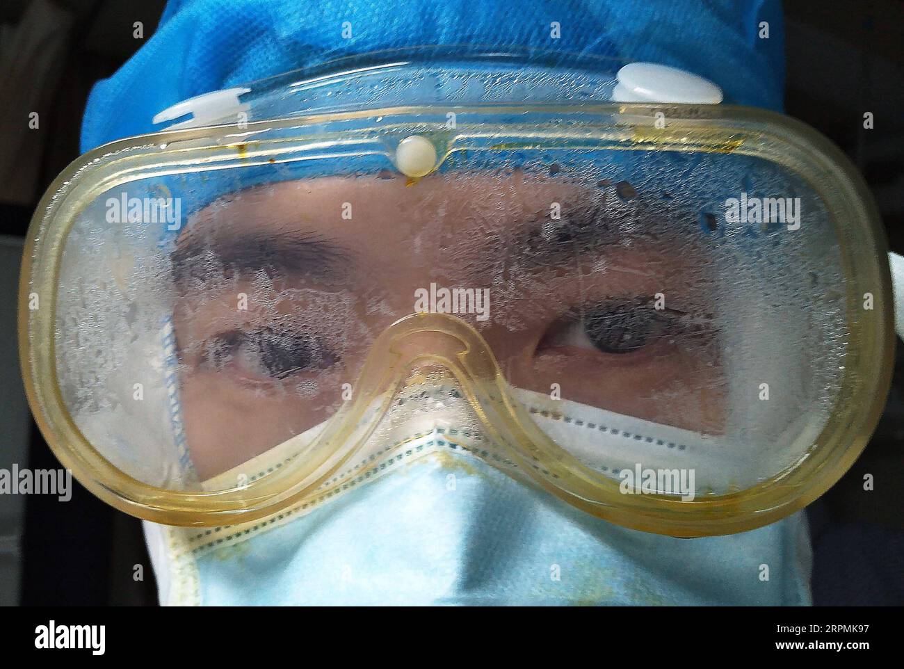 200213 -- NANCHANG, 13. Februar 2020 -- Ein Arzt, Der eine Brille trägt, wird im Xianghu Krankenhaus des ersten angeschlossenen Krankenhauses der Nanchang Universität in Nanchang, Ostchinesische Provinz Jiangxi, 6. Februar 2020 gesehen. Im Zuge des neuartigen Coronavirus-Ausbruchs engagieren sich zahlreiche medizinische Fachkräfte im Kampf gegen das Virus. Am 5. Februar um etwa 20:00 Uhr raste ein Krankenwagen im Xianghu Krankenhaus, zusammen mit schwer erkrankten Patienten, die mit einer neuartigen Coronavirus-Pneumonie aus Fuzhou der Provinz Jiangxi infiziert waren. Ärzte und Krankenschwestern legen sofort Schutzausrüstung an, um die Behandlung durchzuführen. Drei Stunden später, eine weitere Portion Stockfoto