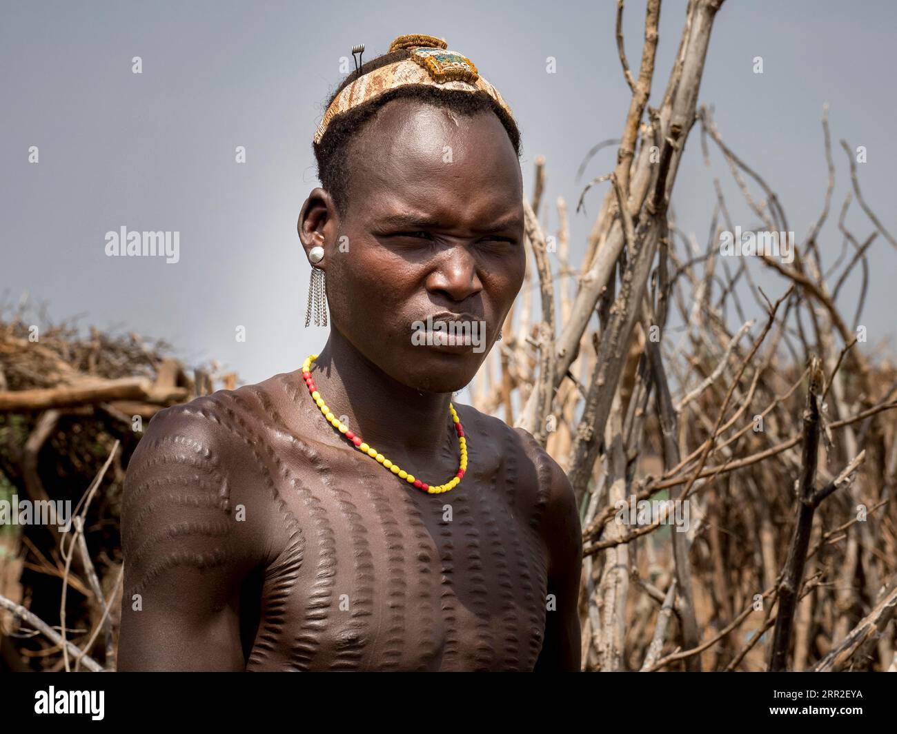 Porträt, Krieger mit Juwelennarben, Dassanech-Stamm, Äthiopien Stockfoto