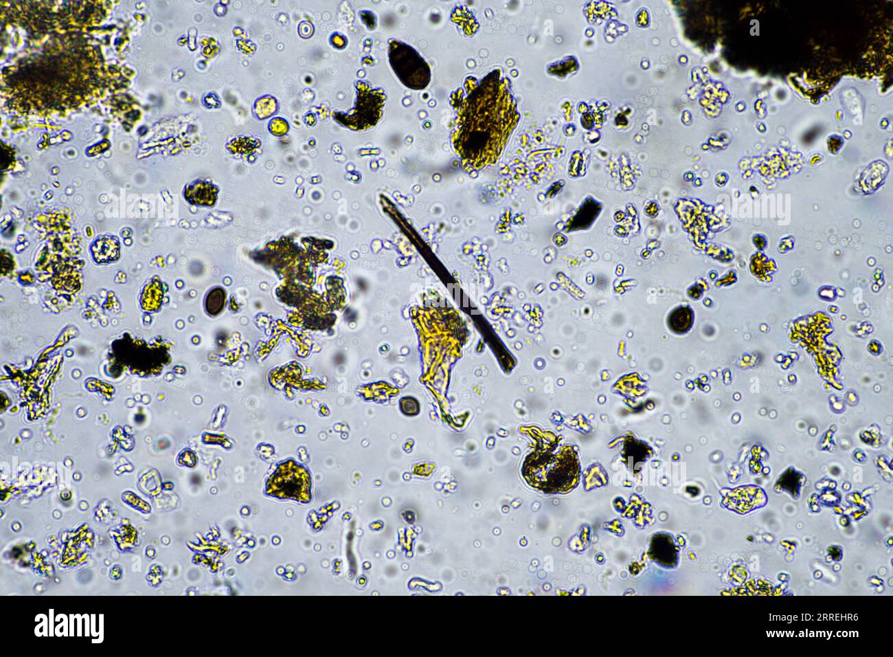 Bodenmikroorganismen aus der Nähe unter dem Mikroskop. In einem Boden aus einem Bauernhof Stockfoto