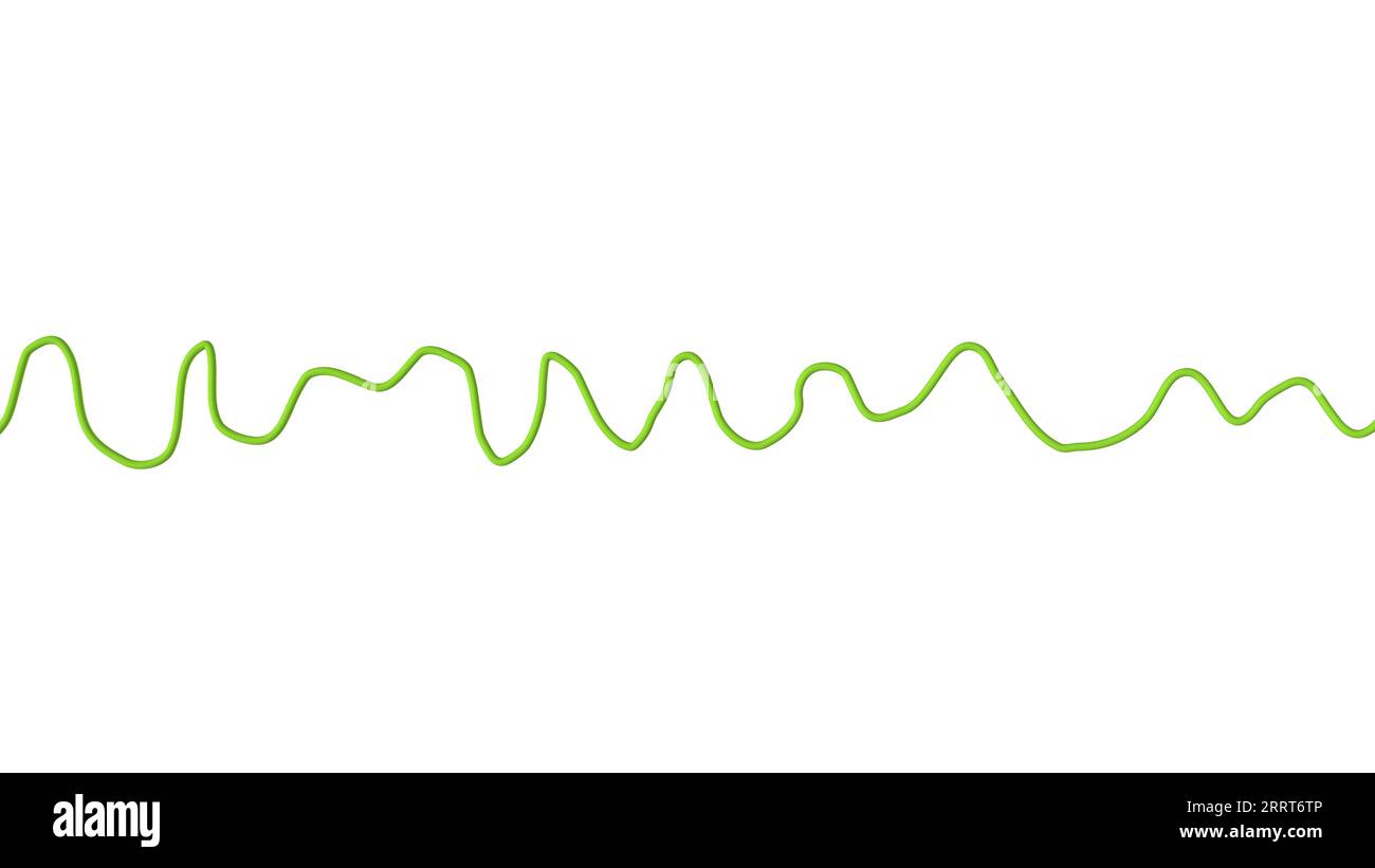 Ventrikulärer Kammerflimmern-Herzrhythmus, Illustration Stockfoto