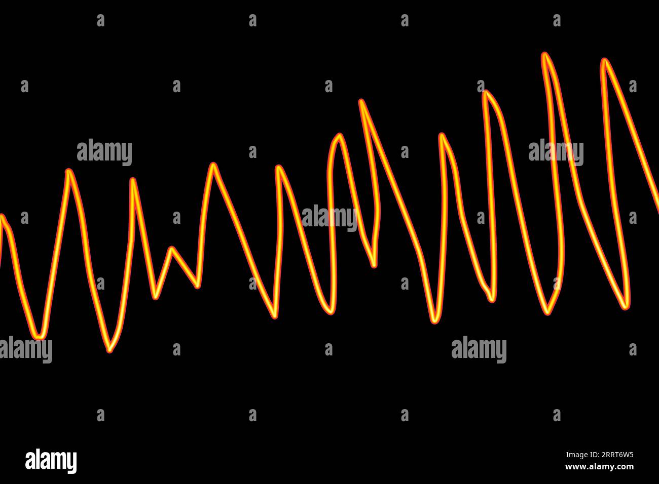 Torsades de pointes Herzrhythmus, Illustration Stockfoto