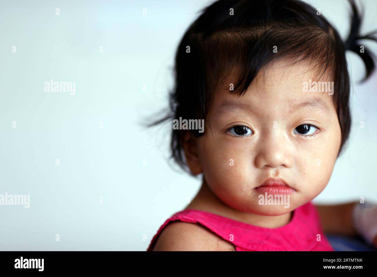 Kinderleiden mit angeborenen Herzfehlern. Die französische NGO Chain of Hope bietet eine kostenlose Behandlung. Ho-Chi-Minh-Stadt. Vietnam. Stockfoto