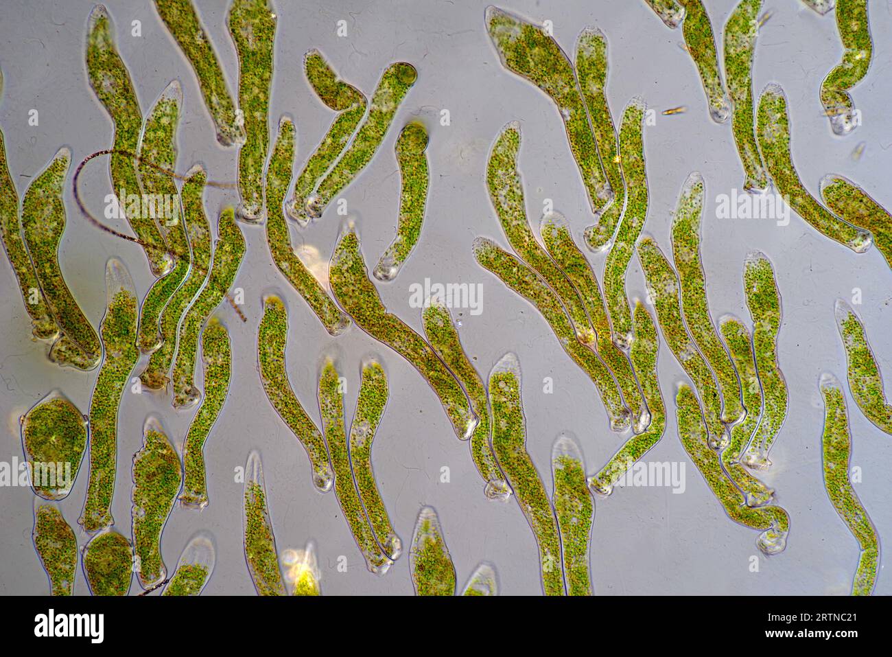 Das Bild zeigt Ophrydium sp. ( Eine Art kolonialer Ziliaten), fotografiert durch das Mikroskop in polarisiertem Licht bei einer Vergrößerung von 100X Stockfoto