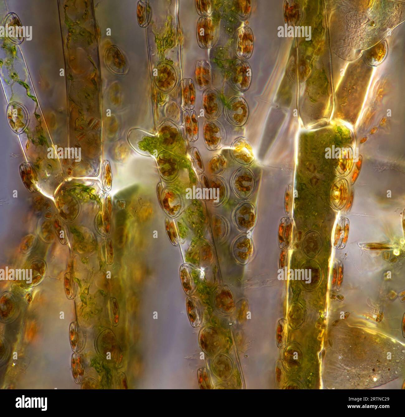 Das Bild zeigt Cladophora sp. „Zweige“ (eine Art Grünalge) mit Cocconeis sp. (Eine Verwandte von Kieselalgen) setzte sich darauf, fotografiert durch das micros Stockfoto