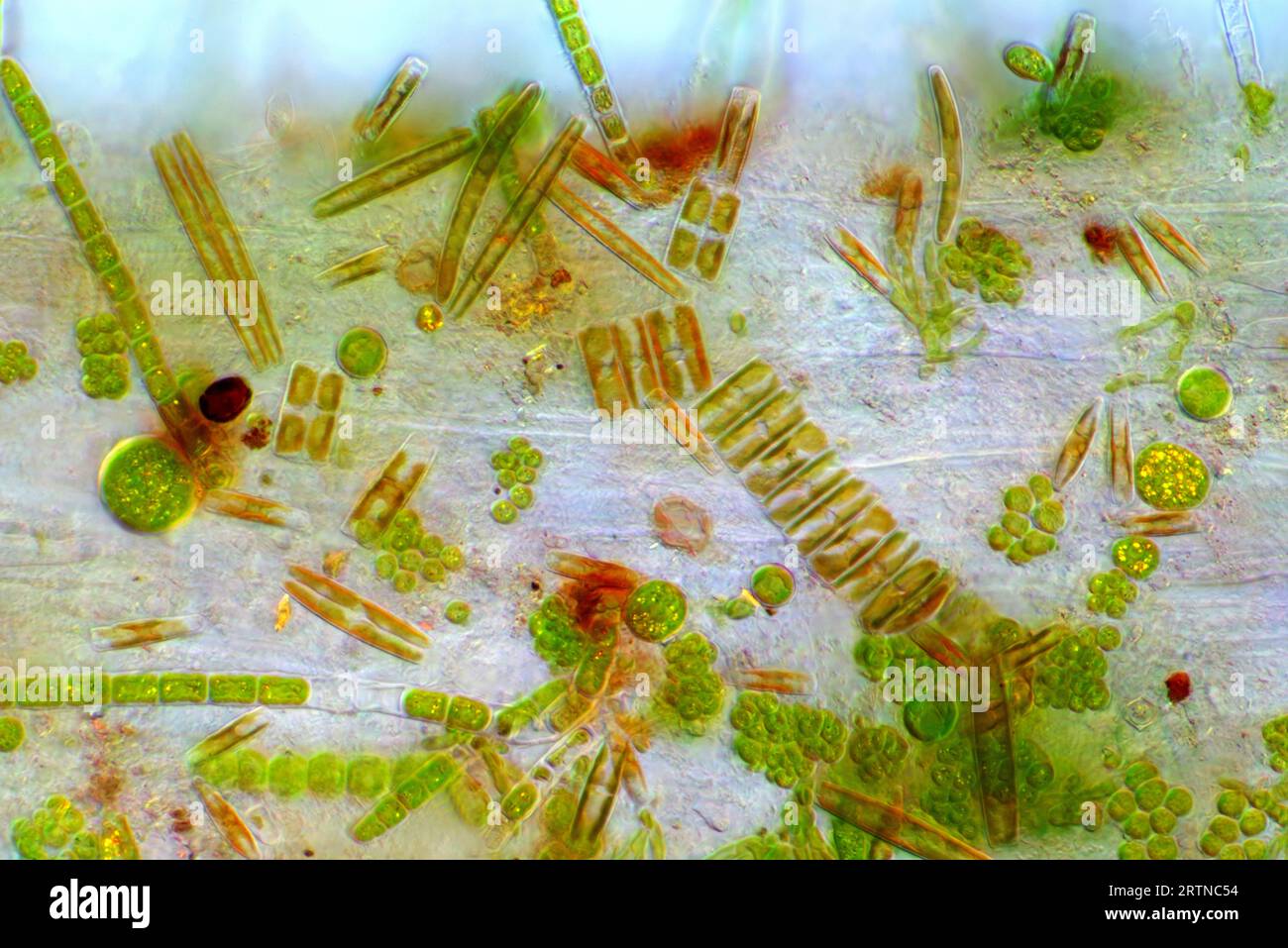 Das Bild zeigt verschiedene winzige Algen, die sich auf Lemna sp. Niedergelassen haben. Wurzel, fotografiert durch das Mikroskop in polarisiertem Licht mit einer Vergrößerung von 200X Stockfoto