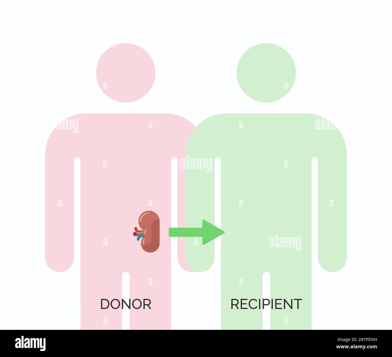 Organtransplantationskonzept des Menschen. Vektorillustration von Spender und Empfänger des Nierenorgan Stock Vektor