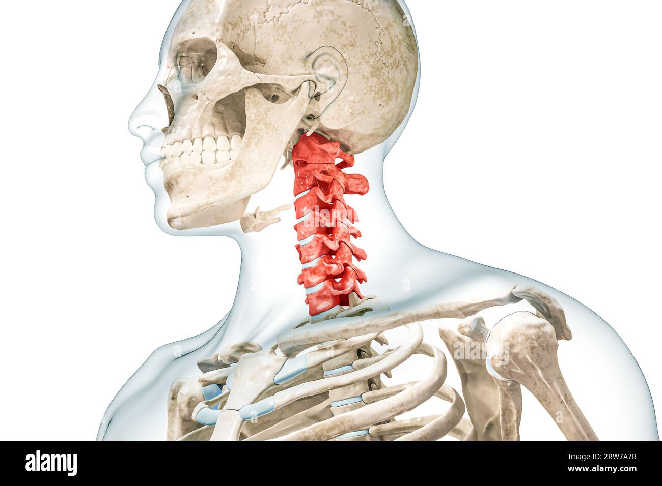 Halswirbel in roter Farbe mit 3D-Darstellung des Körpers isoliert auf weiß. Menschliche Skelett- und Wirbelsäulenanatomie, medizinisches Diagramm, Osteologie, s Stockfoto