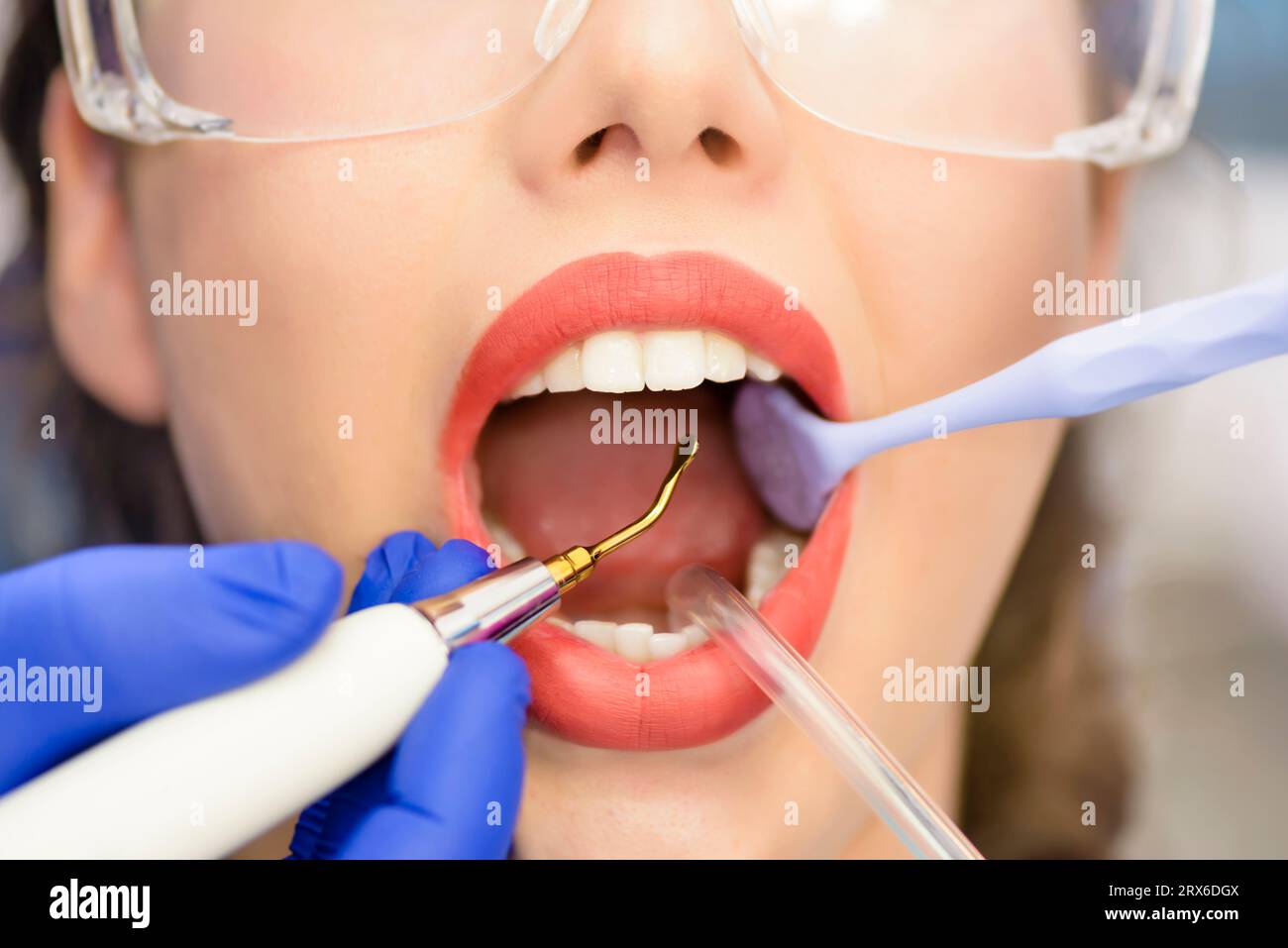 Junge Patientin im zahnärztlichen Eingriff Stockfoto