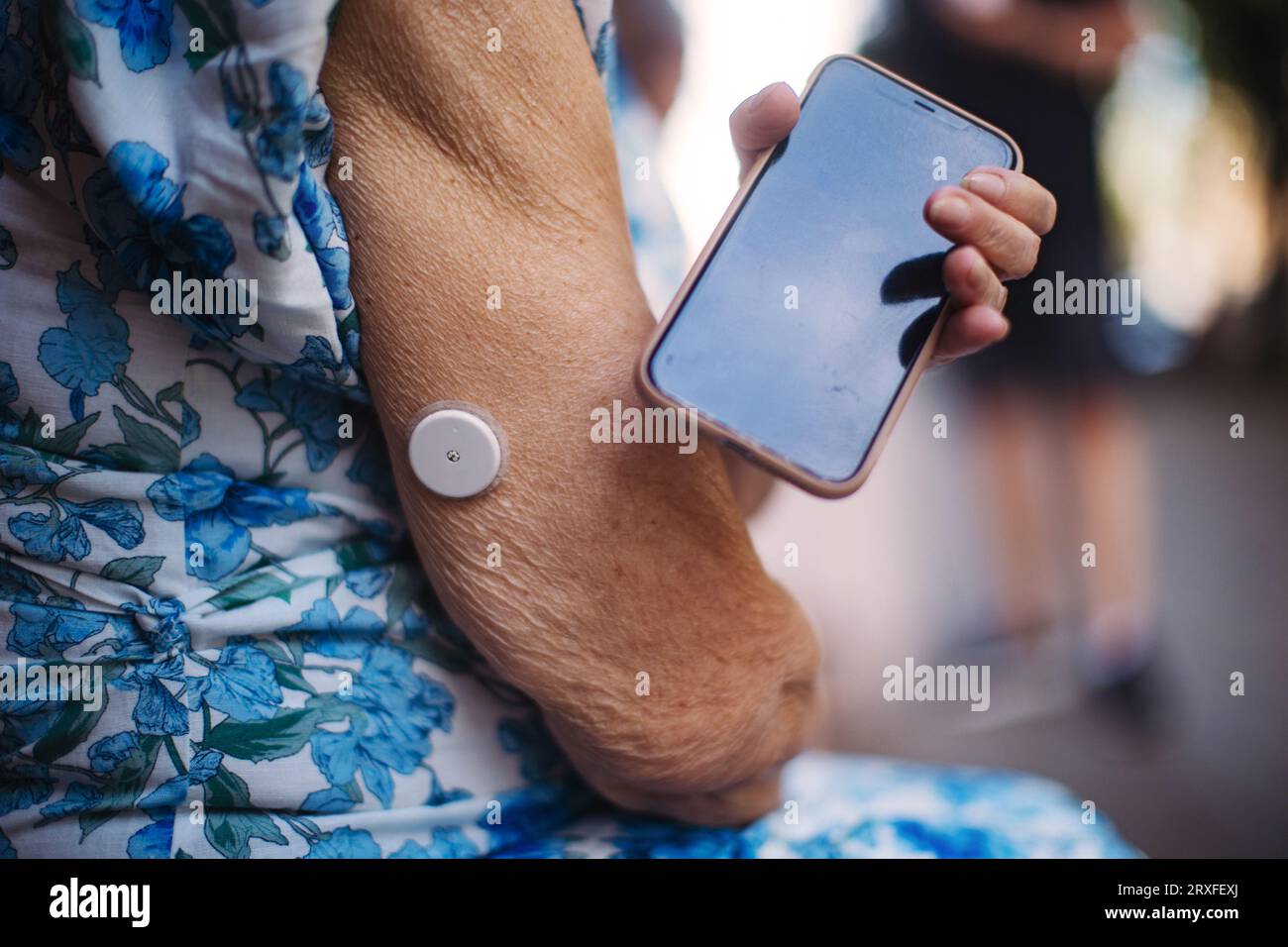 Nahaufnahme des kontinuierlichen Blutzuckersensors am Arm, der mit dem Smartphone verbunden ist. Stockfoto