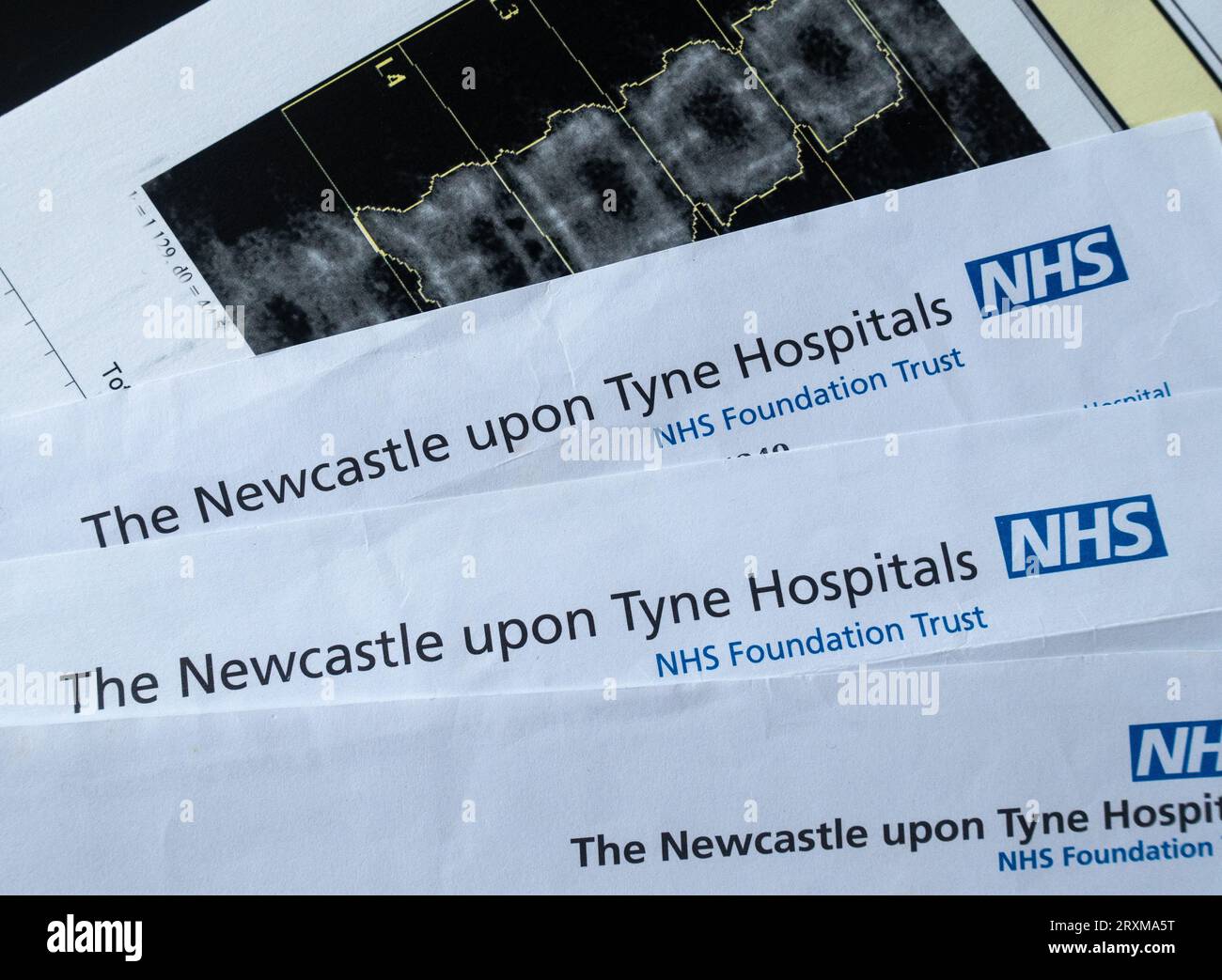 Newcastle NHS Hospitals Foundation Trust Stockfoto